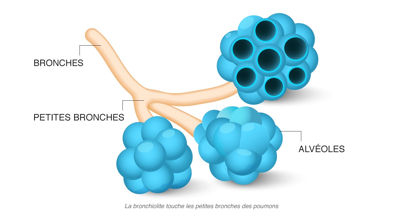 Bronchiolite : les bons gestes et les bons réflexes